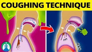 This COUGHING Technique Can Help Get Rid of Mucus and Phlegm ❗