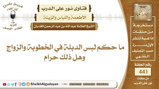 ما حكم لبس الدبلة في الخطوبة والزواج وهل ذلك حرام؟الشيخ عبدالله الغديان image