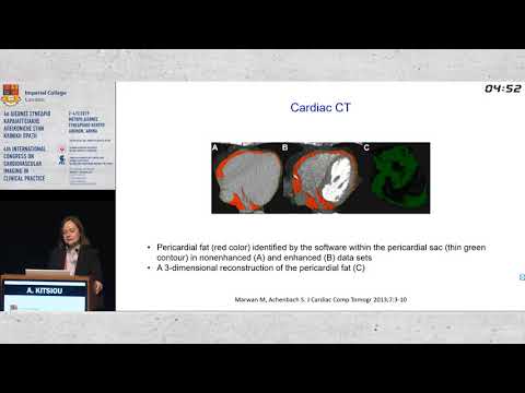 A. Kitsiou  | Adipose tissue as a risk marker for residual cardiovascular risk: How to evaluate a...