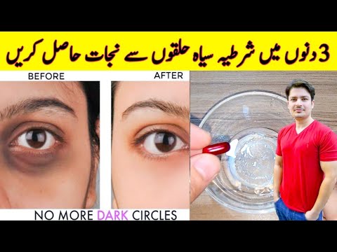 How To Remove Dark Circles Naturally in 3 Days By ijaz Ansari | Dark Circles Homemade Removal Cream