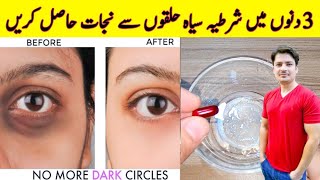 How To Remove Dark Circles Naturally in 3 Days By ijaz Ansari | Dark Circles Homemade Removal Cream
