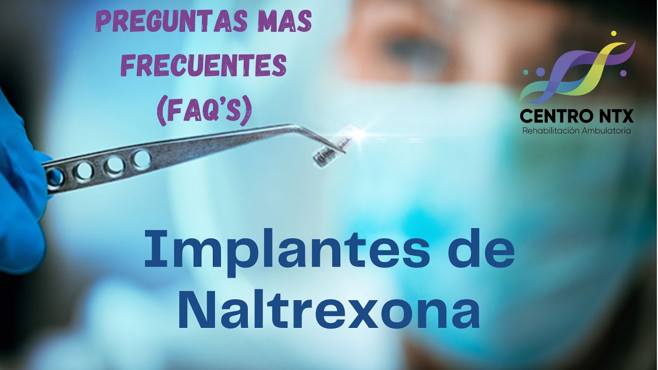 Preguntas más frecuentes (FAQ's) sobre el IMPLANTE NALTREXONA