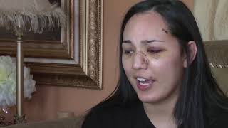 Woman brutally beaten in Nob Hill after night out with friends
