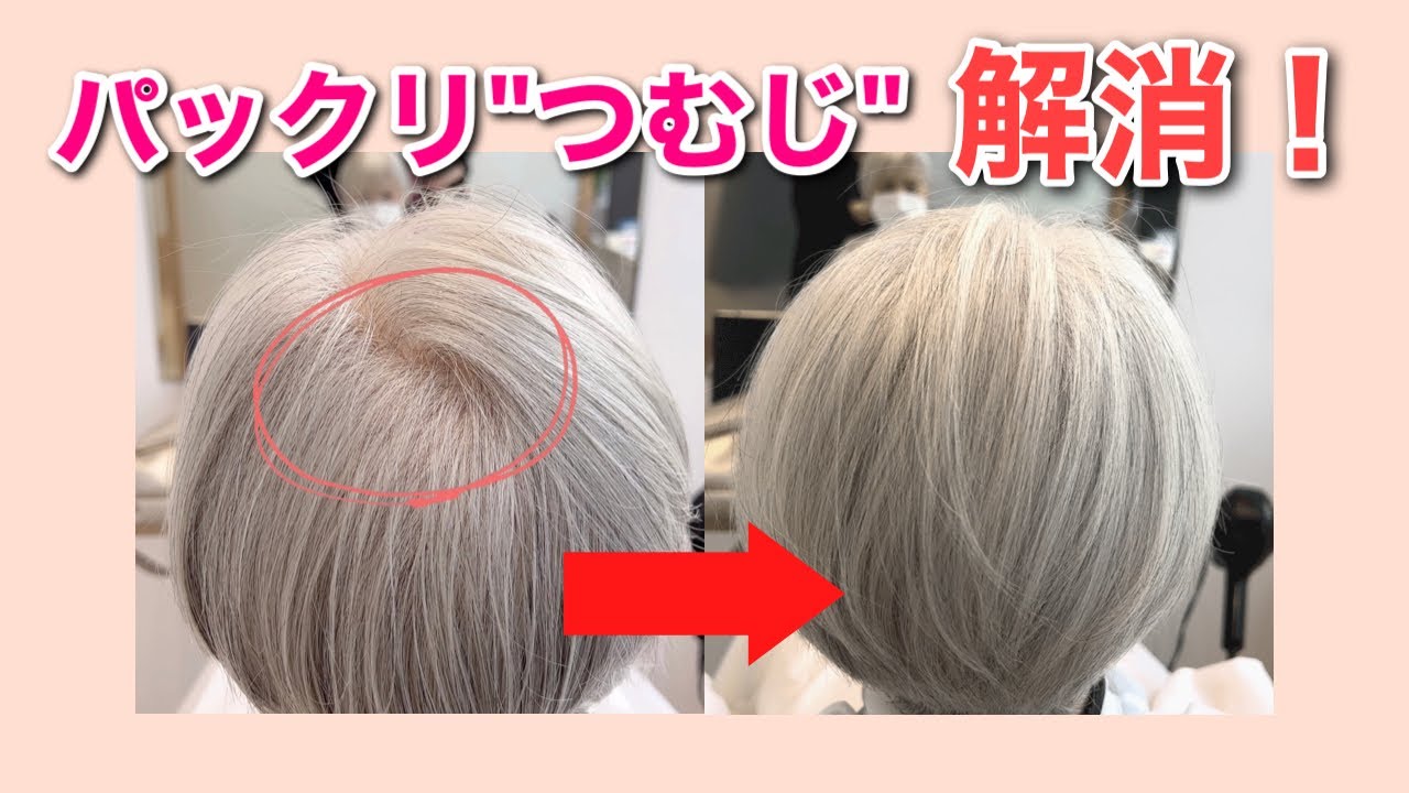 【薄毛】ぱっくり割れる"つむじ"を解消！簡単スタイリングでボリュームアップ！【薄毛対策】