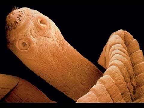 Parassita un tic tac su una faccia Il bambino ebbe un verme che fare