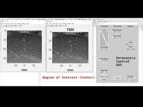 Ultrasound Imaging for Needle Tracking - Multi-region