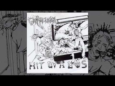 Gory Melanoma video thumbnail