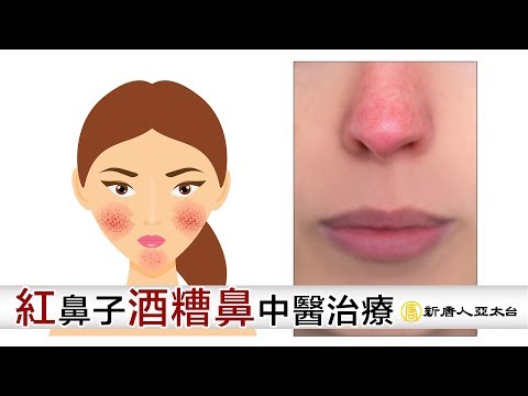 紅糟鼻面相