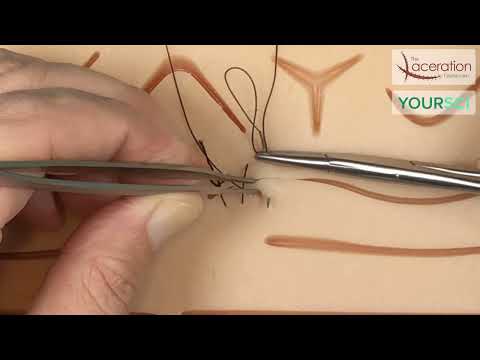 The Simple Running Suture - Baseball Stitch