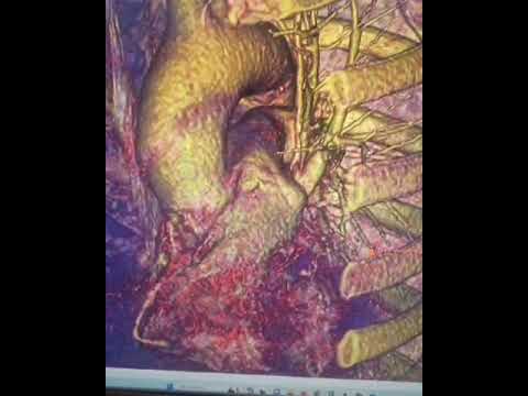 João Victor Ventura De Oliveira-1