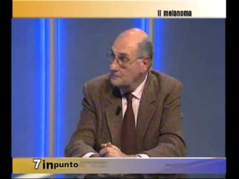 Il Melanoma