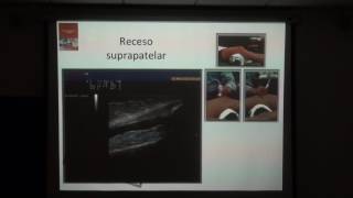 N. GENICULADOS RODILLA 2017. DR DIEGO BENITEZ