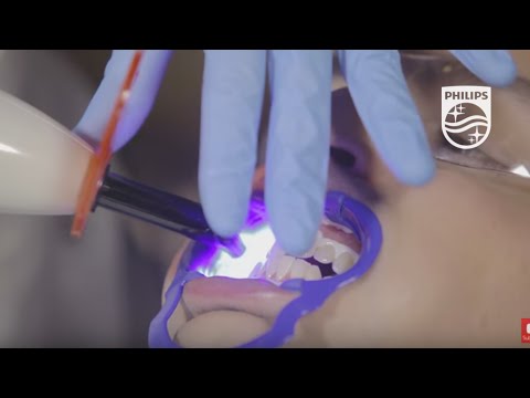 Demo of Zoom QuickPro professional in-office whitening varnish | Philips | Dental Professionals