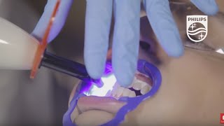 Get a brighter smile in just 15 minutes! Zoom QuickPro Teeth Whitening