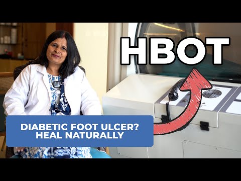 HBOT for Diabetic Foot Ulcer