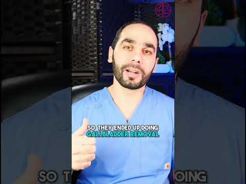 One of the strangest cases of epilepsy!!