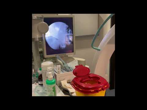 PRT unter C-Bogen: Gezielte Schmerztherapie statt Operation? | LIVE