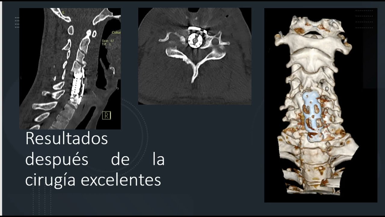 Gerardo Barajas Llanes-27