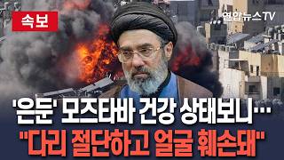 [????속보] NYT 모즈타바, 다리 절단·얼굴 심한 화상…정신은 멀쩡한 상태 / 연합뉴스TV(YonhapnewsTV)