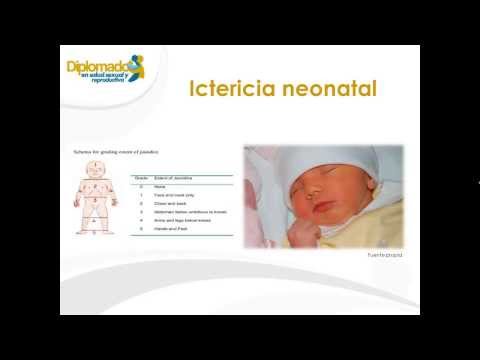Leliminazione di pigmentary nota in Grodno Fototerapia da posti di pigmentary che questo