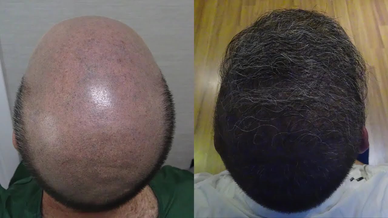 Video 3