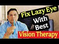 Lazy Eye Treatment How Modern Therapy Is Changing The Game