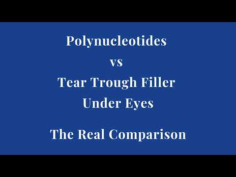 Sculptra vs fillers comparison guide