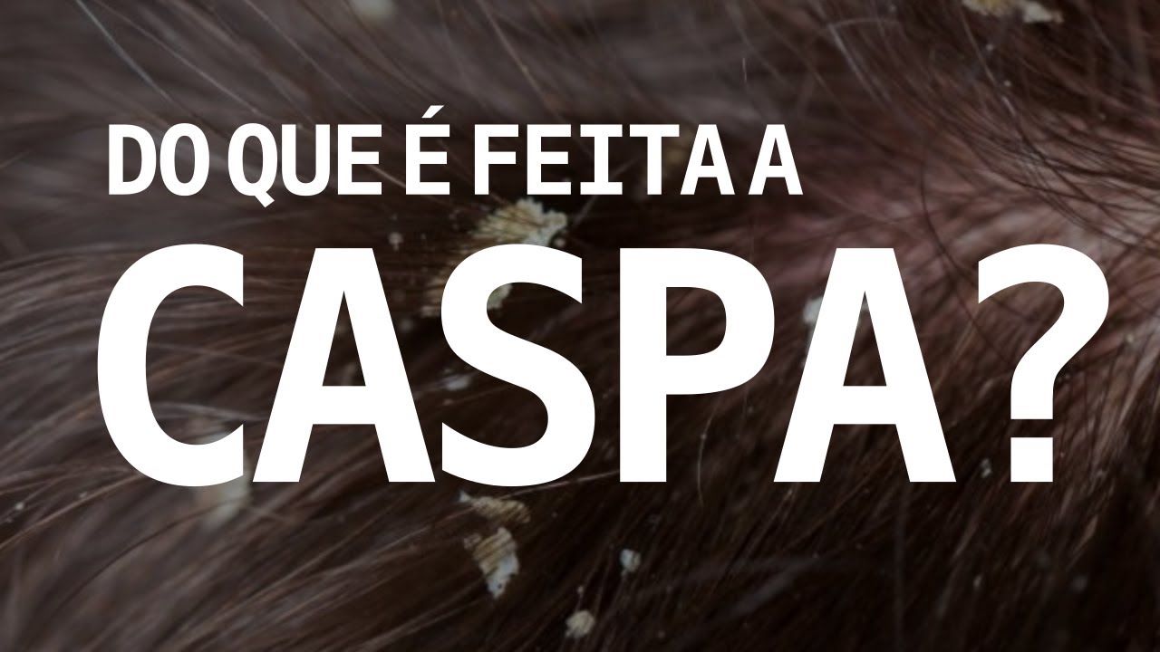 O QUE É A CASPA? 120segundos 38 | BláBláLogia