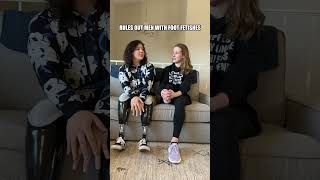 Does amputation affect s*x life...? In one major way 😆