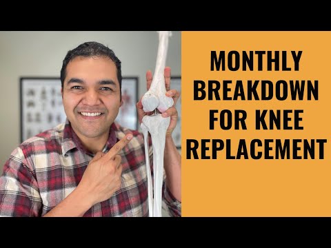 Knee Replacement Surgery - What To Expect Each Month For 12 Months After