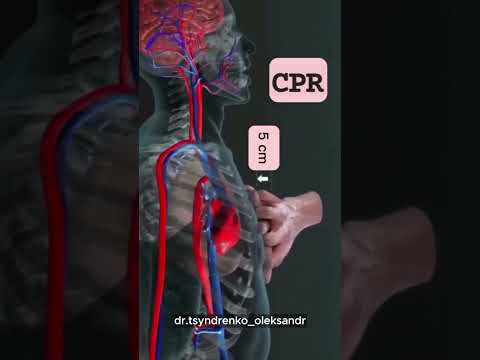 Основы сердечно легочной реанимации #курсмасажу #massage #навчаннямасажу