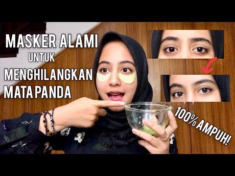 Cara Ampuh Menghilangkan Mata Panda dan Kantung Mata