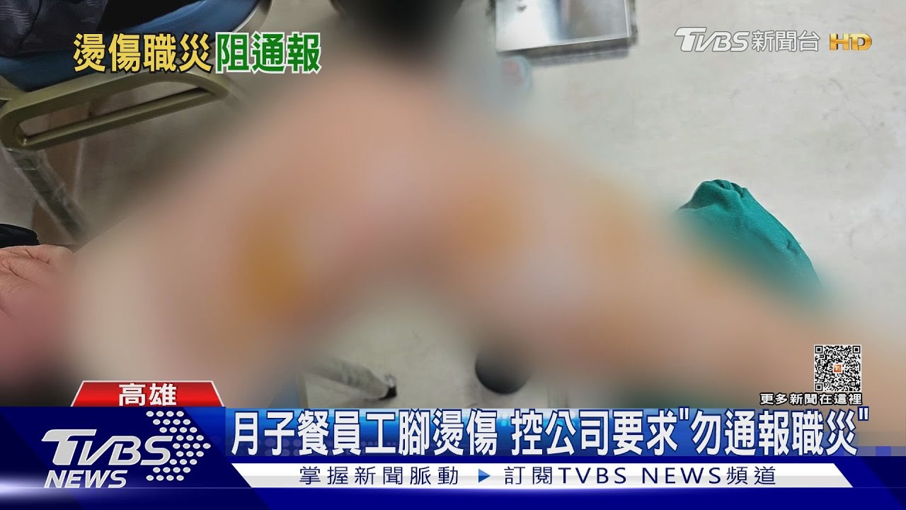 上班燙傷控被要求別通報　月餐業者：員工喊高價賠價