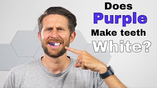Does Purple Really Make Your Teeth Whiter?