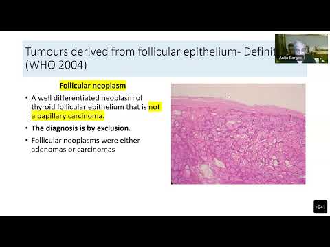 Encapsulated follicular patterned lesions of the thyroid A Historical perspective June 2022