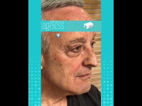 Instantly Ageless®