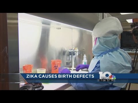 CDC: Zika definitely causes severe birth defects