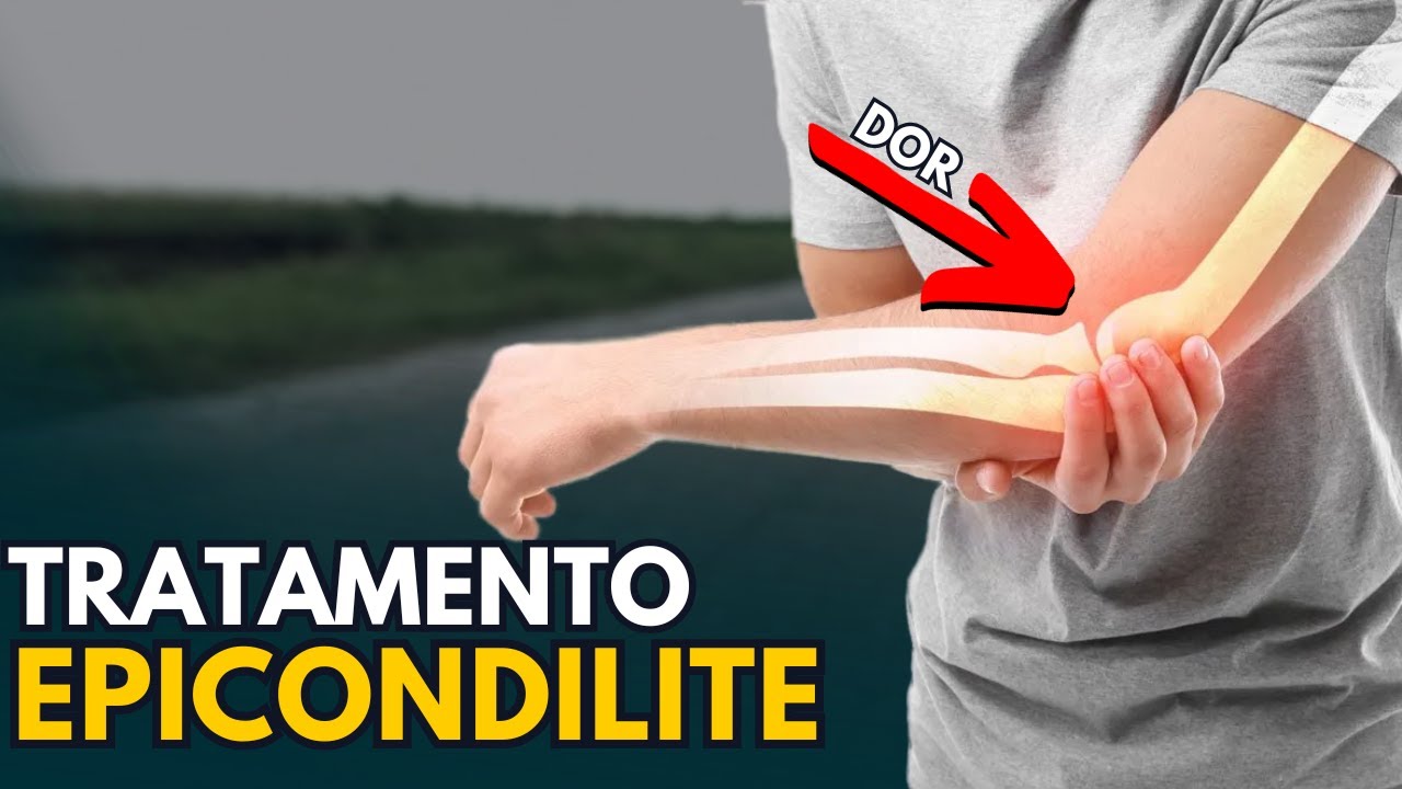 Adeus, Dor no Cotovelo! Saiba Como Tratar a Epicondilite