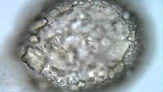 Rotifer eggs inside <em>Netzelia tuberculata</em> shell