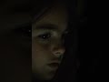 Teaser