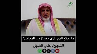 صورة أ.د. علي الشبل | ما حكم الدم الذي يخرج من الدمامل