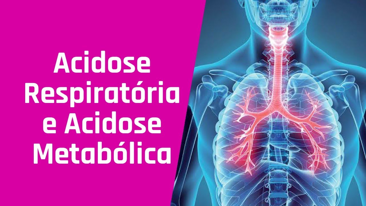 Acidose Respiratória e Acidose Metabólica ( saiba a diferença entre Acidose e alcalose)