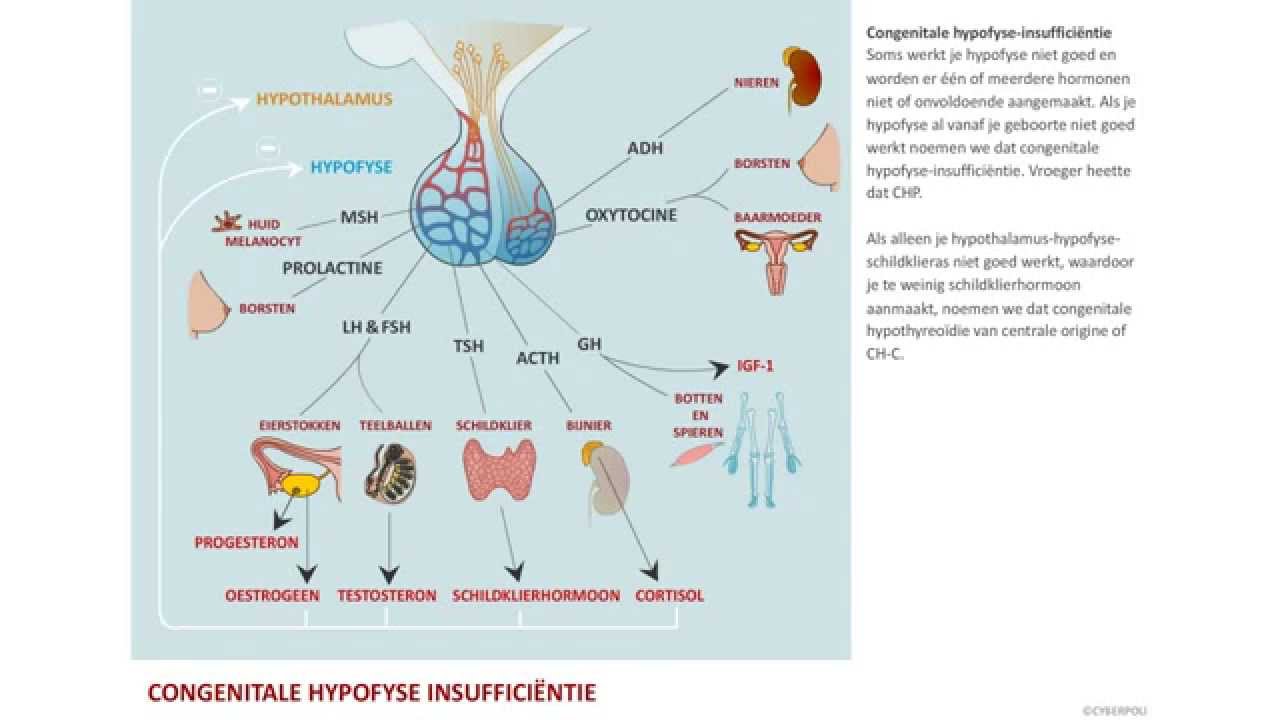 Hypofyse - Congenitale Hypofyse-Insufficiëntie | Cyberpoli