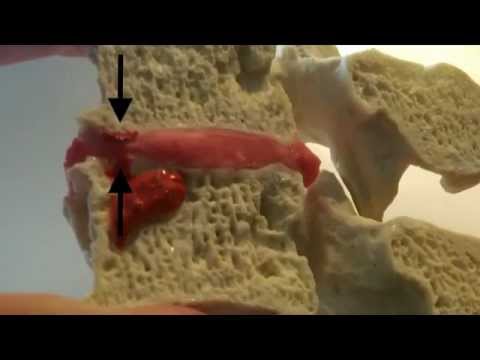 Modic Modeling by Dynamic Disc Designs Corp.