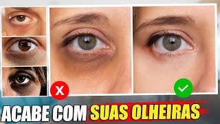 COMO "REMOVER" OLHEIRAS CORRETAMENTE!