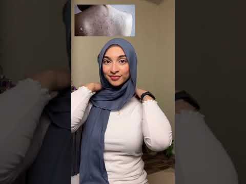 Discover the power of Kalila’s salicylic acid #skincare #dailyskincare #kalila #beauty #makeup