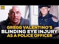 How Gregg Valentino Blinded His Eye During His Time As A Cop