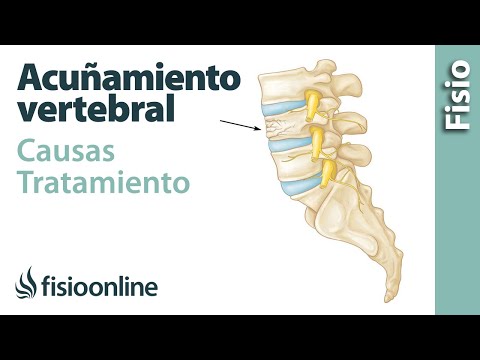 Simulatore Dolinová per le articolazioni Anders Hallgren problemi di comportamento o il mal di schiena