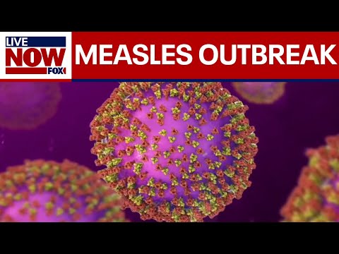 Video | Measles continues to spread across the U.S., 800 confirmed cases