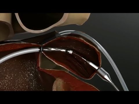 image-What is Texas Heart Institute?